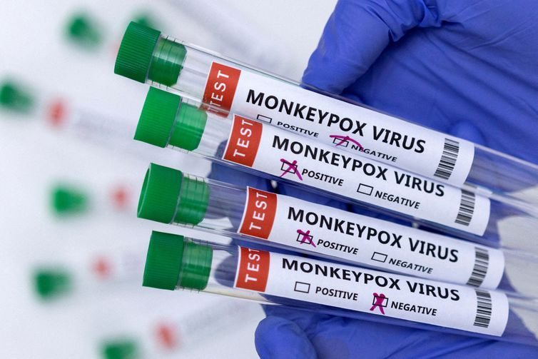 Testes do novo vírus são parecidos com os da Covid-19